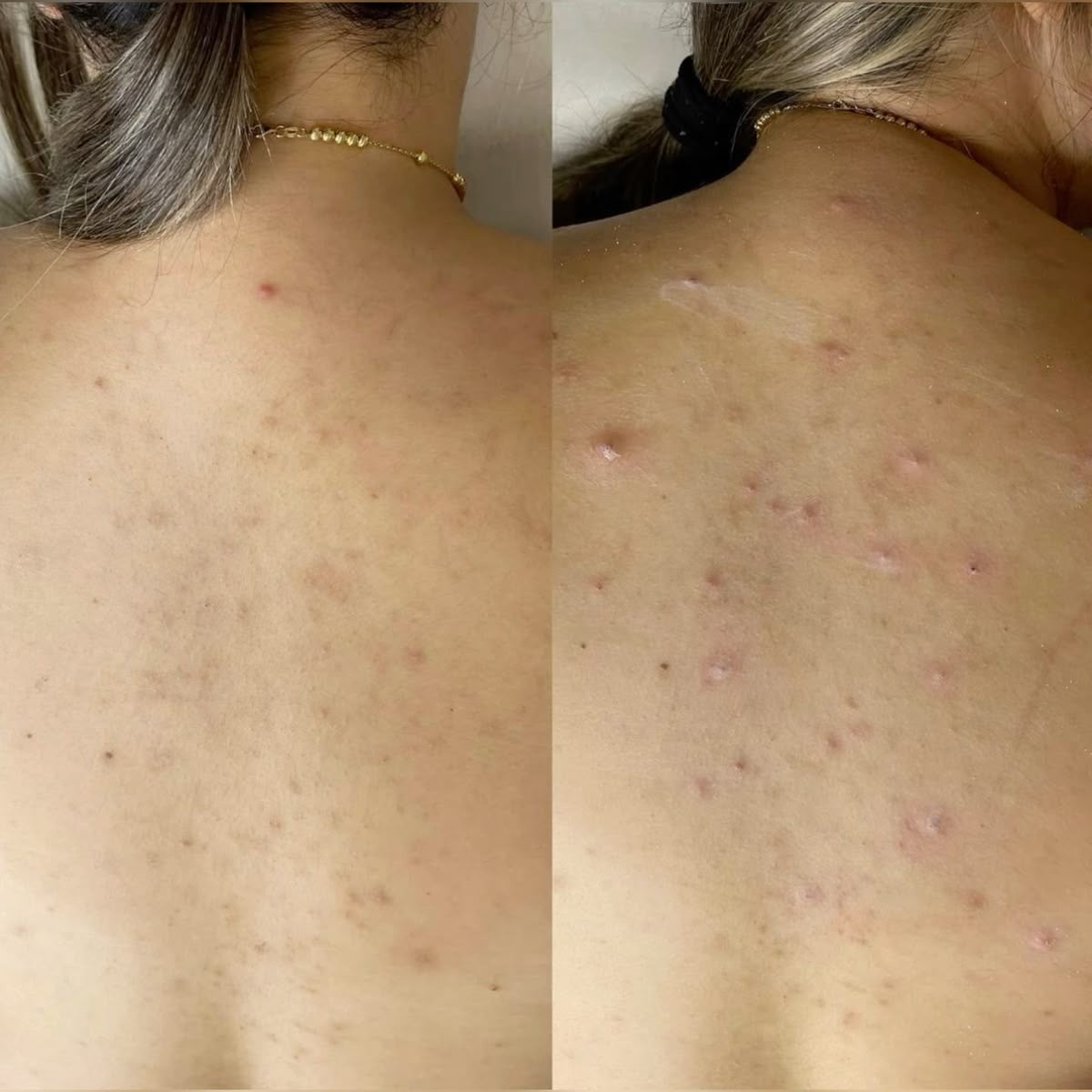 La crème ultime Anti-imperfections