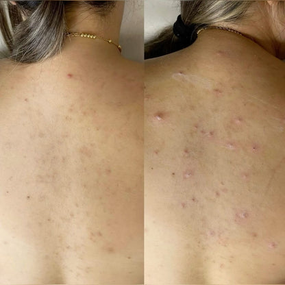 La crème ultime Anti-imperfections