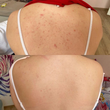 La crème ultime Anti-imperfections