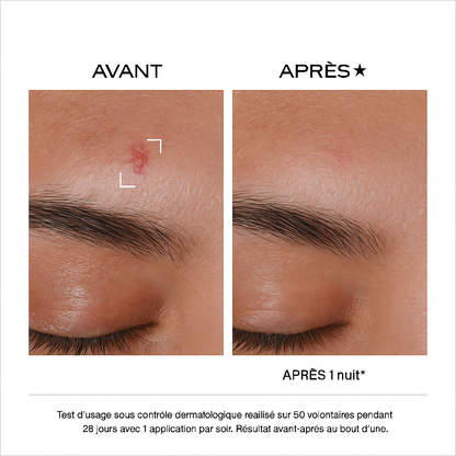 La crème ultime Anti-imperfections